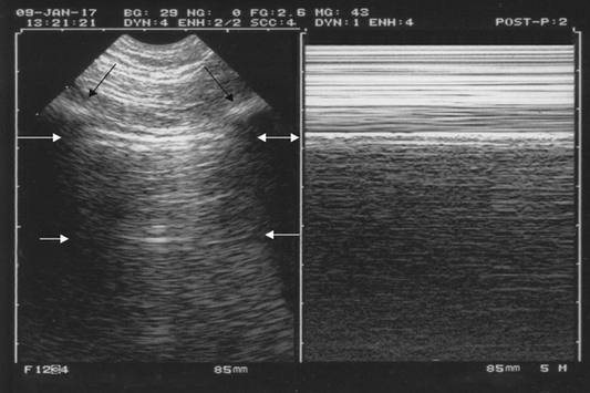 Bedside Emergency Ultrasound (Part 2): Trauma, Lung, Musculoskeletal, Procedures Online Course