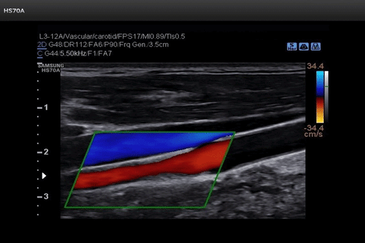 Bedside Emergency Ultrasound (Part 3): BELS Protocol, Basic Echocardiography, IVC Ultrasound Online Course